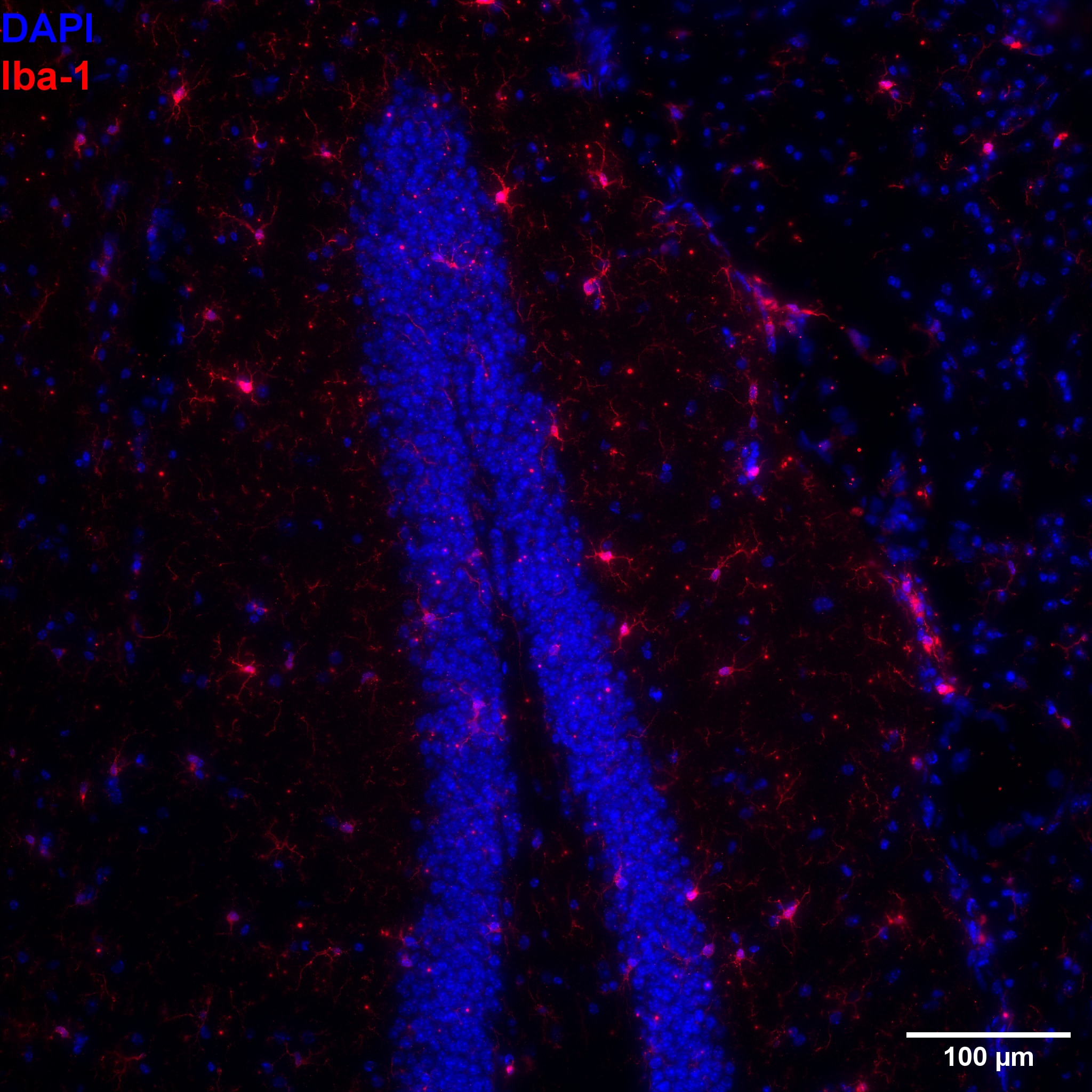 AIF-1/Iba1 Antibody NB100-1028